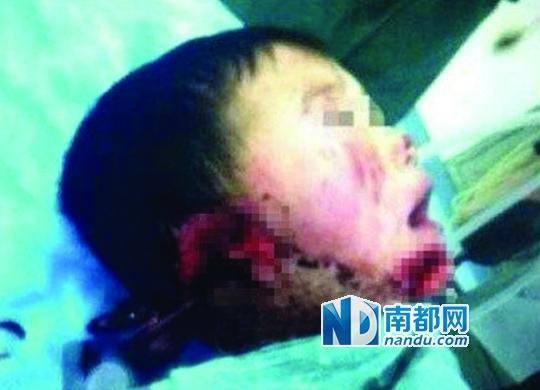 中千万父亲砍伤前妻