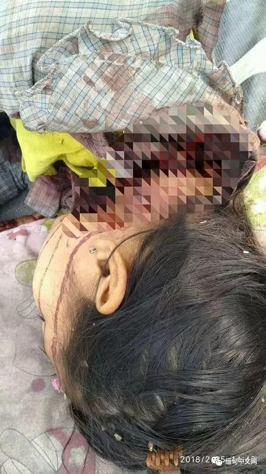 5岁女童伴父母腐尸至少5天后求助