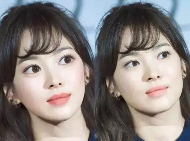 "想变韩女全脸整容"成风潮？揭秘背后的风险与真相！