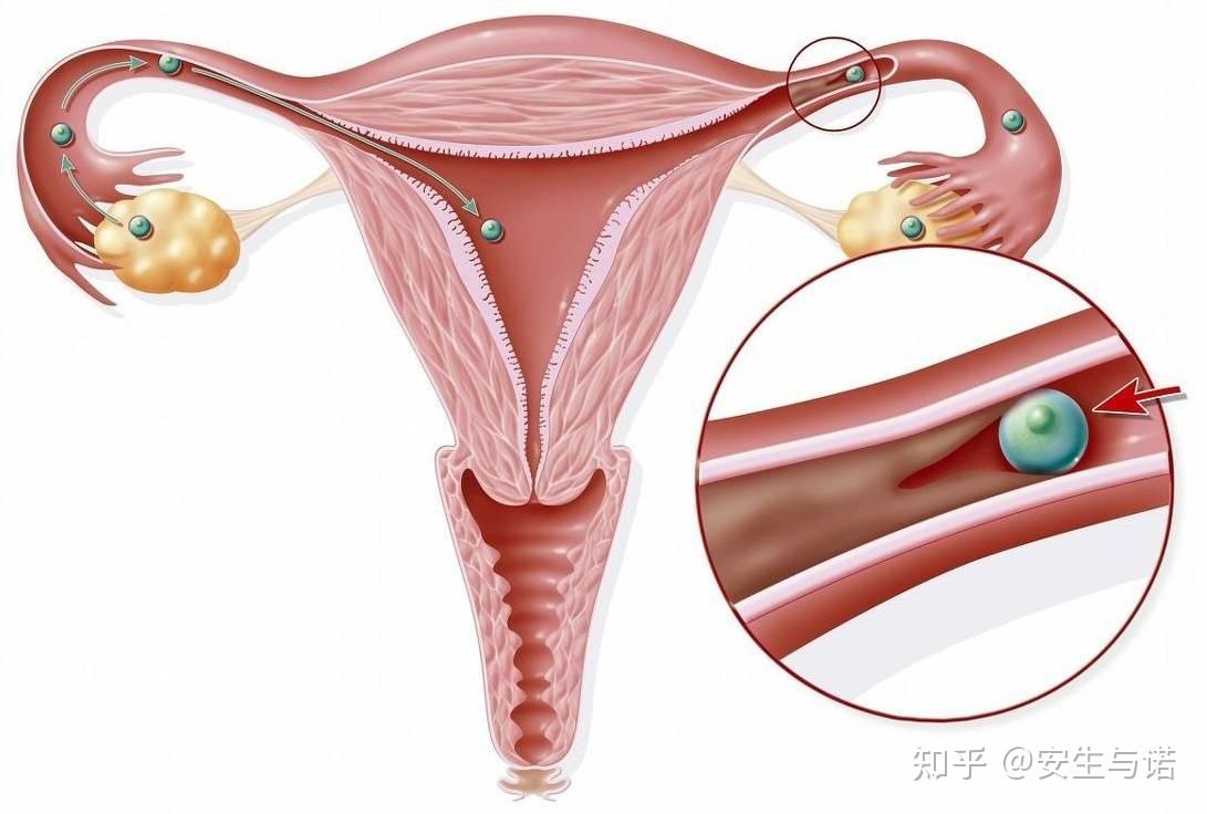 震惊！25岁女孩婚前体检时才发现无子宫，医生：这种情况并不罕见